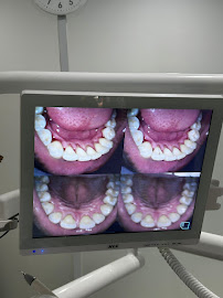 Halona Dental Medical Aesthetic Dokter Gigi Blahbatuh Gianyar