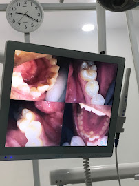 Halona Dental Medical Aesthetic Dokter Gigi Blahbatuh Gianyar