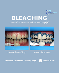 Halona Dental Medical Aesthetic Dokter Gigi Blahbatuh Gianyar