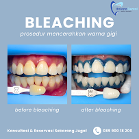 Halona Dental Medical Aesthetic Dokter Gigi Blahbatuh Gianyar
