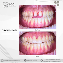 Batubulan Dental Care