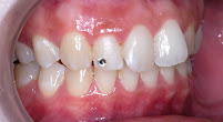 Dentino Dental Care