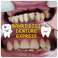 PASANG GIGI TERDEKAT BAHRI GIGI BATUBULAN