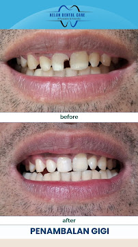 Kelan Dental Care (drg. Agastya Nara Sandhy)