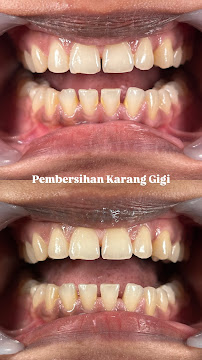 Kelan Dental Care (drg. Agastya Nara Sandhy)