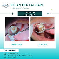 Kelan Dental Care (drg. Agastya Nara Sandhy)