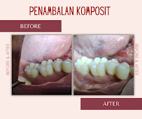 Kelan Dental Care (drg. Agastya Nara Sandhy)