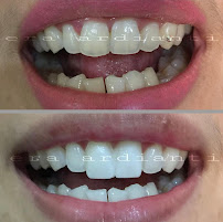 GLOW Dental Bali by drg. Era Ardianti (Dokter Gigi - Dentist - Дантист)