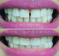 GLOW Dental Bali by drg. Era Ardianti (Dokter Gigi - Dentist - Дантист)