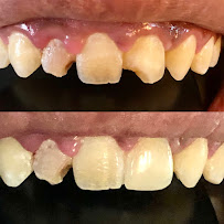 GLOW Dental Bali by drg. Era Ardianti (Dokter Gigi - Dentist - Дантист)
