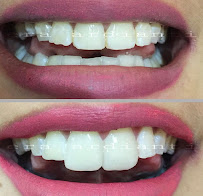 GLOW Dental Bali by drg. Era Ardianti (Dokter Gigi - Dentist - Дантист)