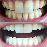 GLOW Dental Bali by drg. Era Ardianti (Dokter Gigi - Dentist - Дантист)