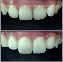 GLOW Dental Bali by drg. Era Ardianti (Dokter Gigi - Dentist - Дантист)