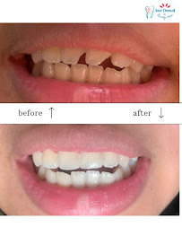 Jati Dental Care