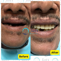 Jati Dental Care