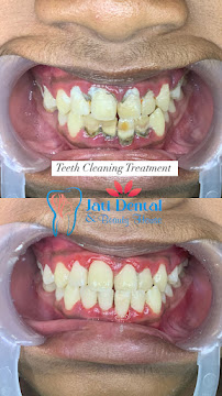 Jati Dental Care