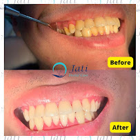 Jati Dental Care