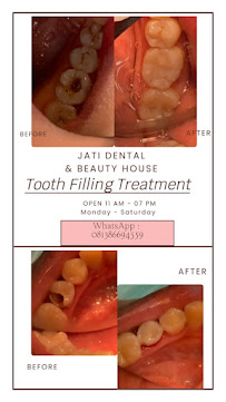 Jati Dental Care