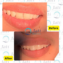 Jati Dental Care