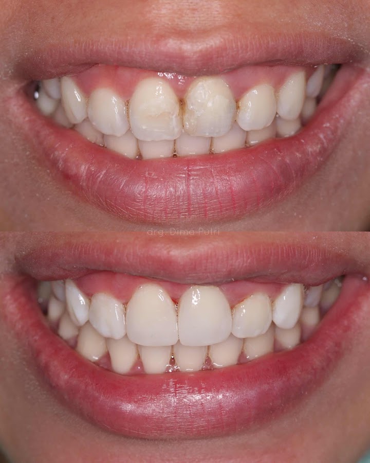 Dima Putri Saraswati dental clinic