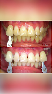 Dentist Dima Putri Saraswati (KITA Dental)