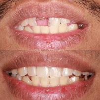 Dentist Dima Putri Saraswati (KITA Dental)