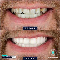 Omer Istanbul Dental Clinic Turkey