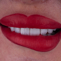 Omer Istanbul Dental Clinic Turkey