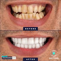 Omer Istanbul Dental Clinic Turkey