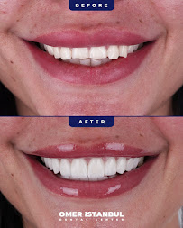 Omer Istanbul Dental Clinic Turkey