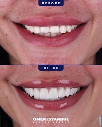Omer Istanbul Dental Clinic Turkey