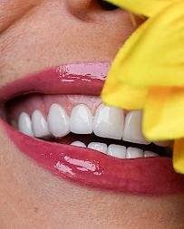 Omer Istanbul Dental Clinic Turkey