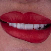 Omer Istanbul Dental Clinic Turkey