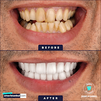 Omer Istanbul Dental Clinic Turkey