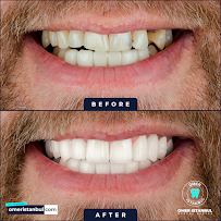 Omer Istanbul Dental Clinic Turkey