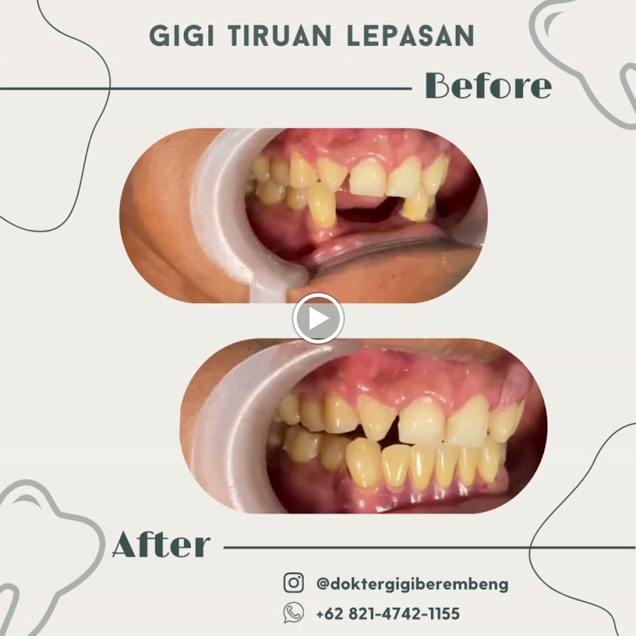 Dokter Gigi Berembeng dental clinic