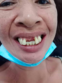 Ahli Gigi BALI DENTAL
