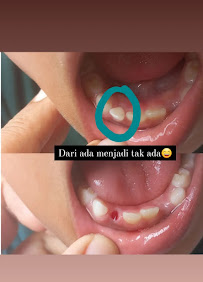 PRAKTEK TERAPIS GIGI DAN MULUT "DEWA AYU PUTRI DWIJAWATI"