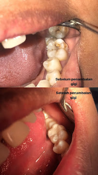 drg. Putu Fenti Surya Pratami - Dokter Gigi Bali