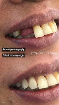 drg. Putu Fenti Surya Pratami - Dokter Gigi Bali