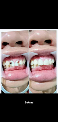 IMRON DENTAL