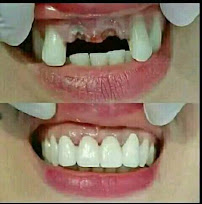 IMRON DENTAL