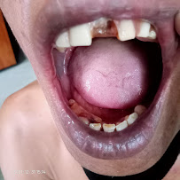 AHLI TUKANG GIGI SINGARAJA BULELENG BALI
