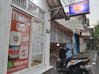 Tukang Gigi Singaraja in Bali