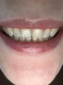 CitySmile