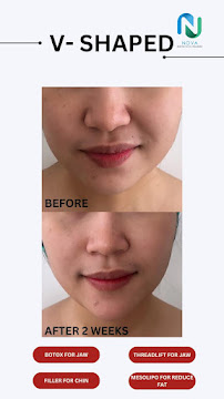 Nova Aesthetics Dental & Wellness