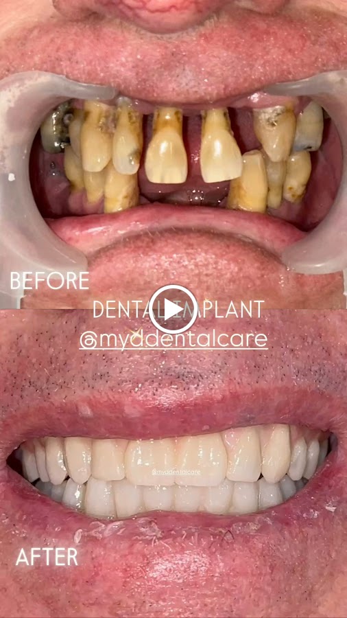Myd Bali dental clinic