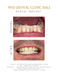 MYD DENTAL CLINIC BALI