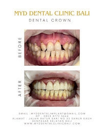 MYD DENTAL CLINIC BALI