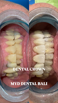 MYD DENTAL CLINIC BALI